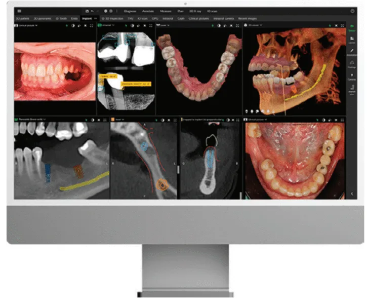 DEXIS is a renowned leader in dental imaging because of its ecosystem of products. 